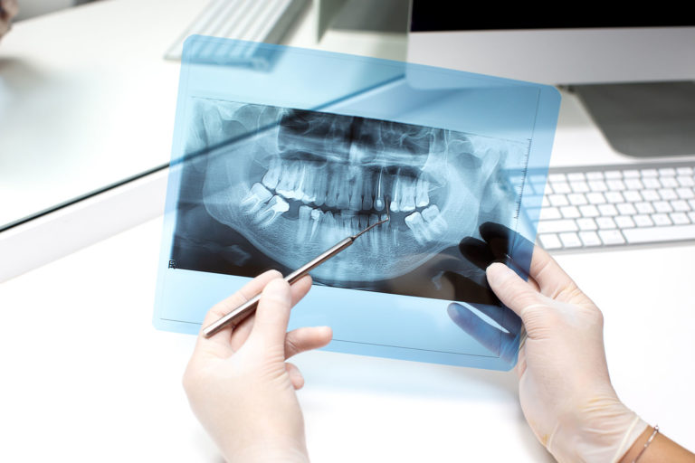 Extensão em Radiologia Odontológica